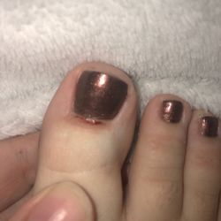 Fancy Nails - This is a pic of it now.. this happened about 4 hours ago!