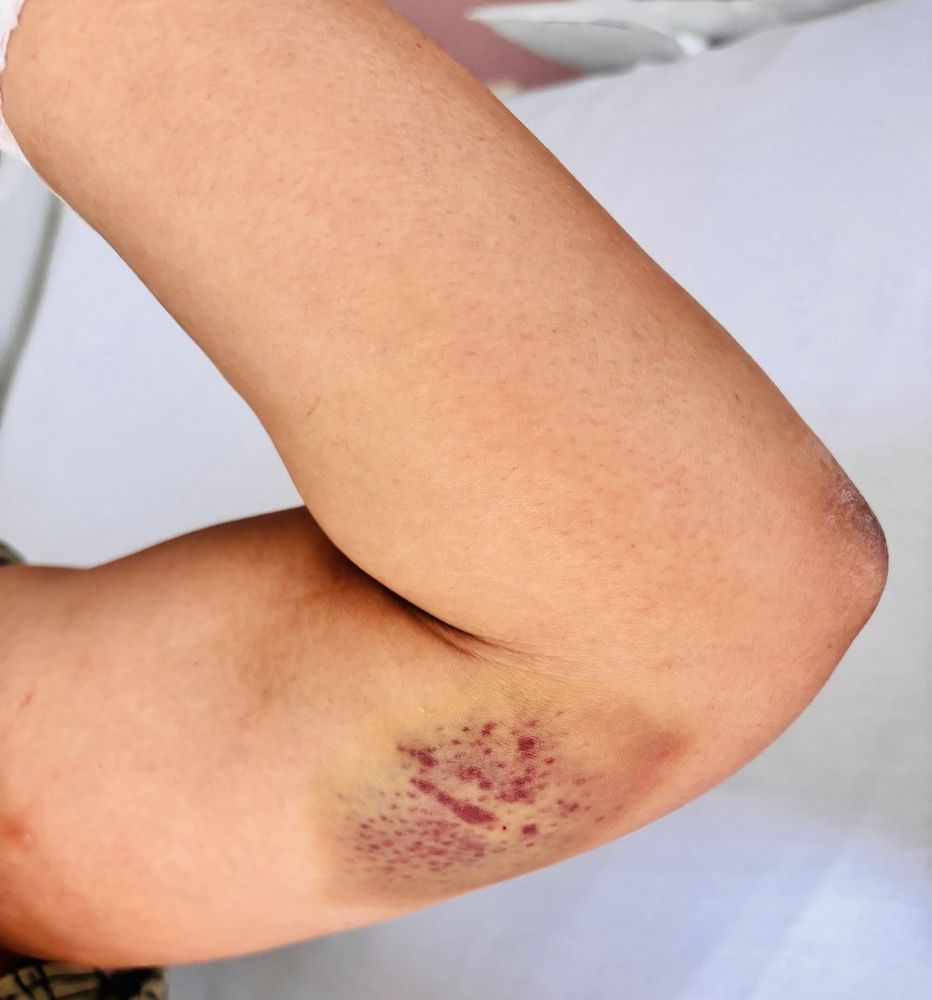 St Mark's Hospital - patient advocate in Salt Lake City, UT