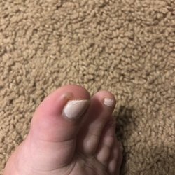 X - Clusive Nails - My green toe