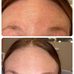 DayDreams MedSpa & Retreat - Daxxify (neurotoxin injection) available. Call or text (402) 672-8483 for a free consultation.