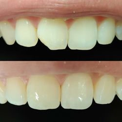 Daybreak Dental - Top: before Bottom: after