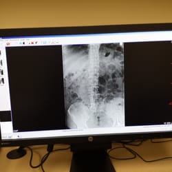 Wheaton Franciscan Medical Group - Yup there it is, so I am definitely not spineless as my ex wife said.