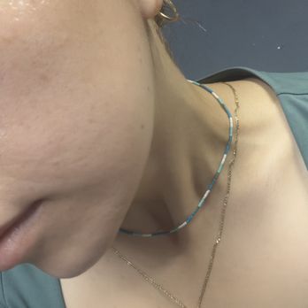 Luxfit Medspa - My skin one day after treatment - Skin Care Near Me - La Habra, California Luxfit Medspa - My skin one day after treatment - Skin Care Near Me - La Habra, California