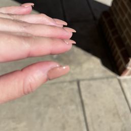 Nail damage