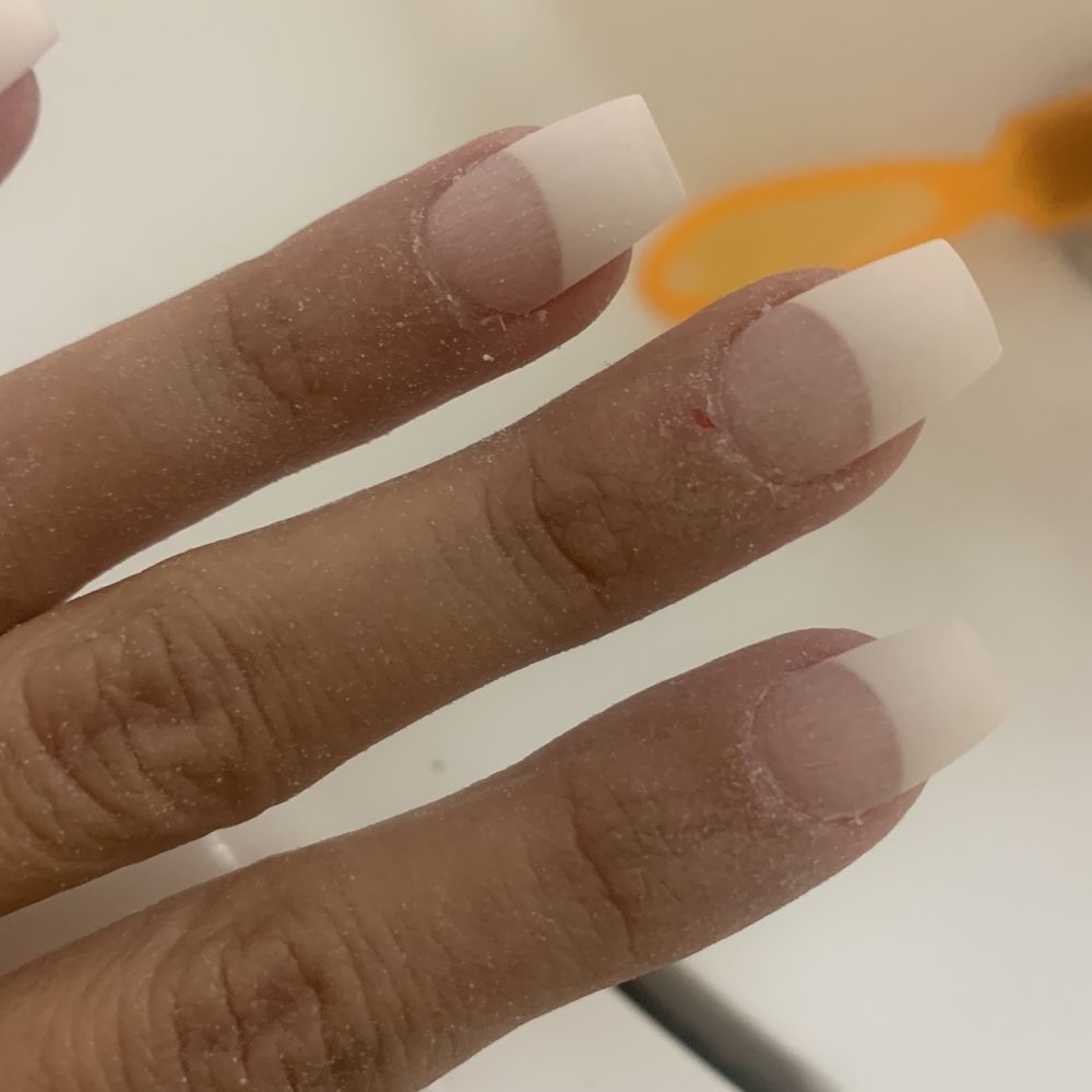 Bad nail job and cuts
