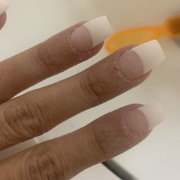 Bad nail job and cuts Bad nail job and cuts