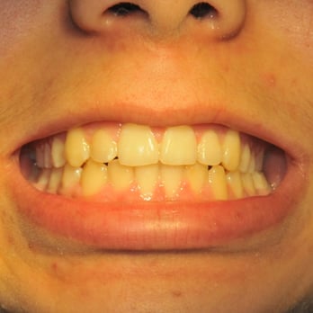 Franciss Zamora, DDS - Emergency Dental Services in Torrance, CA - Endodontists Near Me - Torrance, California Franciss Zamora, DDS - Emergency Dental Services in Torrance, CA - Endodontists Near Me - Torrance, California
