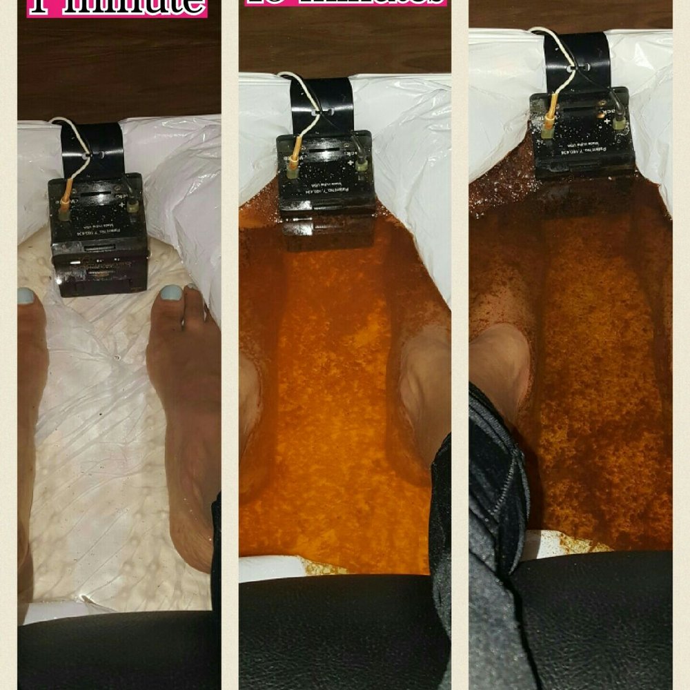 Oasis Massage - A relaxing foot detox. Fascinating to see the stages of the detox. - Massage Near Me - Suwanee, Georgia Oasis Massage - A relaxing foot detox. Fascinating to see the stages of the detox. - Massage Near Me - Suwanee, Georgia