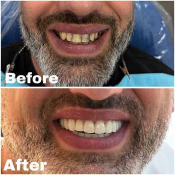 Crystal Bright Smile - REAL RESULTS, NO AI !!! - Cosmetic Dentists Near Me - Tujunga, California Crystal Bright Smile - REAL RESULTS, NO AI !!! - Cosmetic Dentists Near Me - Tujunga, California