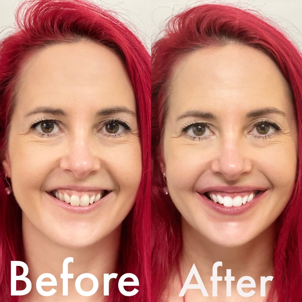 WHYT TEETH BRIGHTENING CENTRE Updated September 2024 Request an