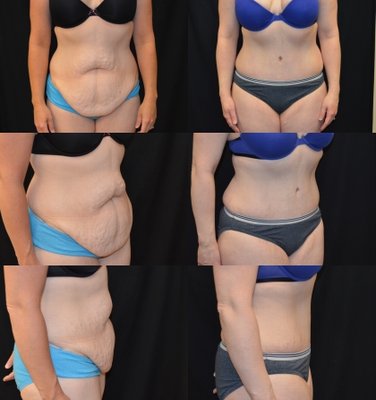 Baroody Plastic Surgery by null