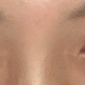 Dior Lash Studio - Post removal. extreme pain, crust, my right eye looks like a blood vessel popped in it because of the fume exposure - Eyelash Service Near Me - Corona, California Dior Lash Studio - Post removal. extreme pain, crust, my right eye looks like a blood vessel popped in it because of the fume exposure - Eyelash Service Near Me - Corona, California