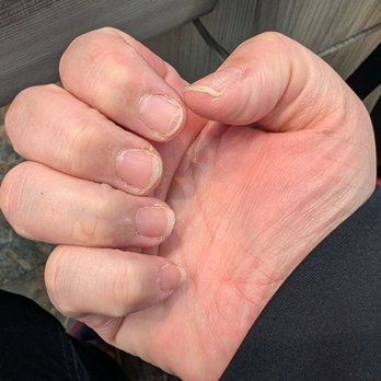 @ Nails - Before - Nail Salons Near Me - San Luis Obispo, California @ Nails - Before - Nail Salons Near Me - San Luis Obispo, California