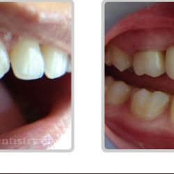 Veronica Avalos, DDS