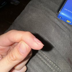 Cozy Nails - Nail almost non existent after acrylic removal.