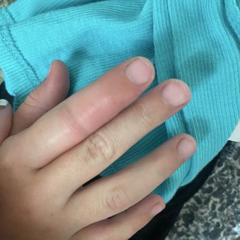 Right At School - Injury at right at school - Child Care & Day Care Near Me - Evanston, Illinois Right At School - Injury at right at school - Child Care & Day Care Near Me - Evanston, Illinois