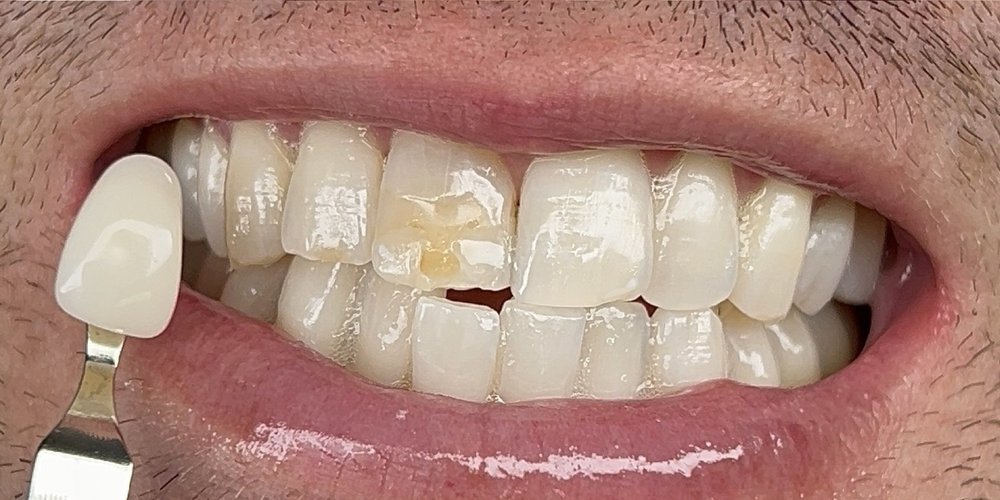 The Coco Blanc Teeth Whitening Logo