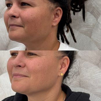 Collagen Project - Medical Spas Near Me - Miami Beach, Florida
