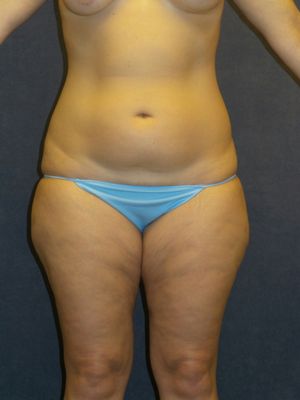 semaglutide weight loss union city ca THE BEST 10 WEIGHT LOSS CENTERS NEAR UNION CITY, CA 94587 - UPDATED JUNE  2026 - HOURS