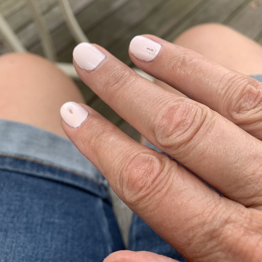 Ruined nails