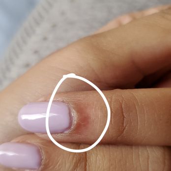 Perfect Nails Spa - Skin under nail is very red and irritated, I'm afraid it might be infected from the cut. - Nail Salons Near Me - American Canyon, California Perfect Nails Spa - Skin under nail is very red and irritated, I'm afraid it might be infected from the cut. - Nail Salons Near Me - American Canyon, California