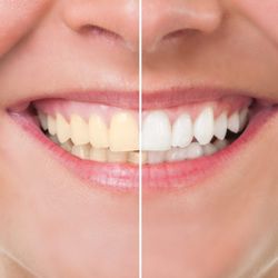Evergreen Dental