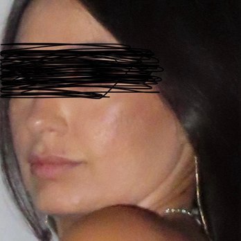 Reddy Aesthetics - Now (also with makeup) - Medical Spas Near Me - Long Beach, California