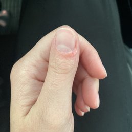 Left over nail polish from getting it "removed" Left over nail polish from getting it "removed"