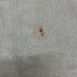 Looks like blood to me Looks like blood to me