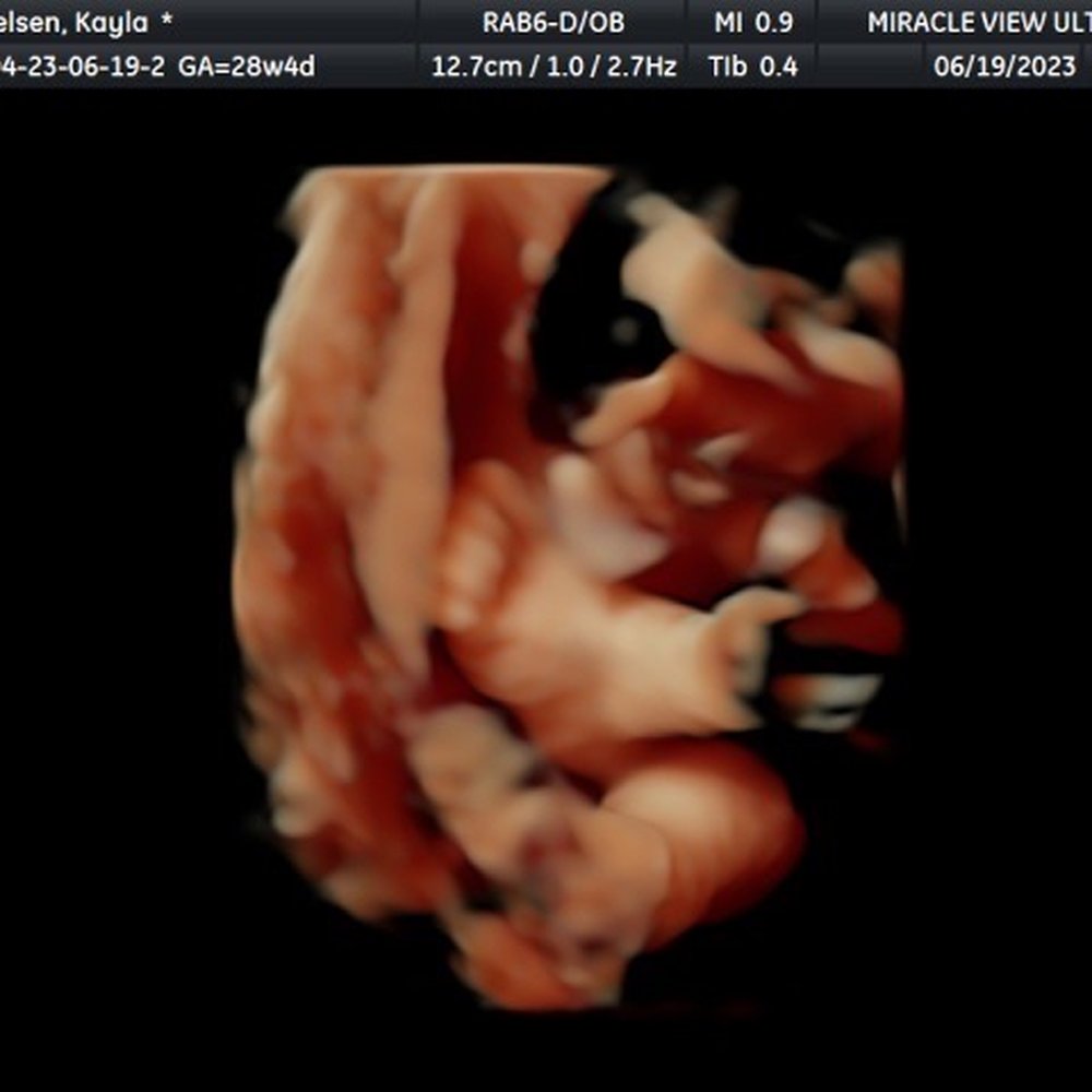 Miracle View 3D/4D Ultrasound - Obstetricians & Gynecologists Near Me - Phoenix, Arizona Miracle View 3D/4D Ultrasound - Obstetricians & Gynecologists Near Me - Phoenix, Arizona