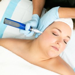SkinSpirit - Seattle - We recommend microneedling or micropenning to brighten the skin and address texture.