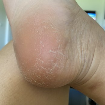 Capri Spa & Nails - I paid $48+ 20% tip for this kind of dirty pedicure. Very disappointed. - Nail Salons Near Me - Katy, Texas Capri Spa & Nails - I paid $48+ 20% tip for this kind of dirty pedicure. Very disappointed. - Nail Salons Near Me - Katy, Texas