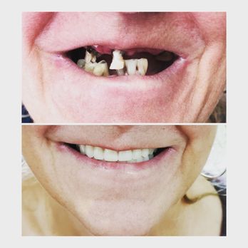 Kasper Denture Clinic - General Dentistry Near Me - Vernon, British Columbia Kasper Denture Clinic - General Dentistry Near Me - Vernon, British Columbia