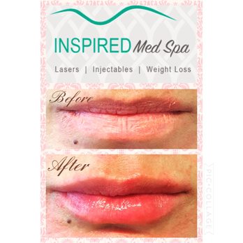 Inspired Med Spa - Medical Spas Near Me - Rancho Cucamonga, California Inspired Med Spa - Medical Spas Near Me - Rancho Cucamonga, California