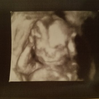 Womb Service 3D/4D Ultrasound Studio - Diagnostic Imaging Near Me - Audubon, New Jersey Womb Service 3D/4D Ultrasound Studio - Diagnostic Imaging Near Me - Audubon, New Jersey