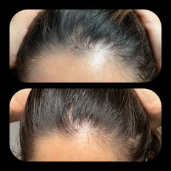 Face & Body Laser Hawaii - Nutrafol 1st treatment