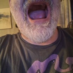 Dental Partners - East Ridge - WHAT $24,000 Got me