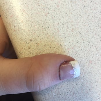 Zen Nails & Spa - This was 2 days after getting nails done. Still bleeding and swollen. - Nail Salons Near Me - Braintree, Massachusetts