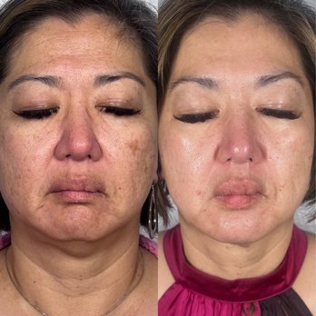 Sheila Marie Aesthetics - Before and after - Eyelash Service Near Me - San Mateo, California Sheila Marie Aesthetics - Before and after - Eyelash Service Near Me - San Mateo, California