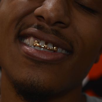 Baltimore Gold Fronts - Jewelry Near Me - Baltimore, Maryland Baltimore Gold Fronts - Jewelry Near Me - Baltimore, Maryland