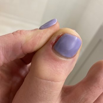 America Nails & Spa - Big toe - sore/red after my aggressive pedicure. My poor cuticles - Nail Salons Near Me - Aurora, Colorado