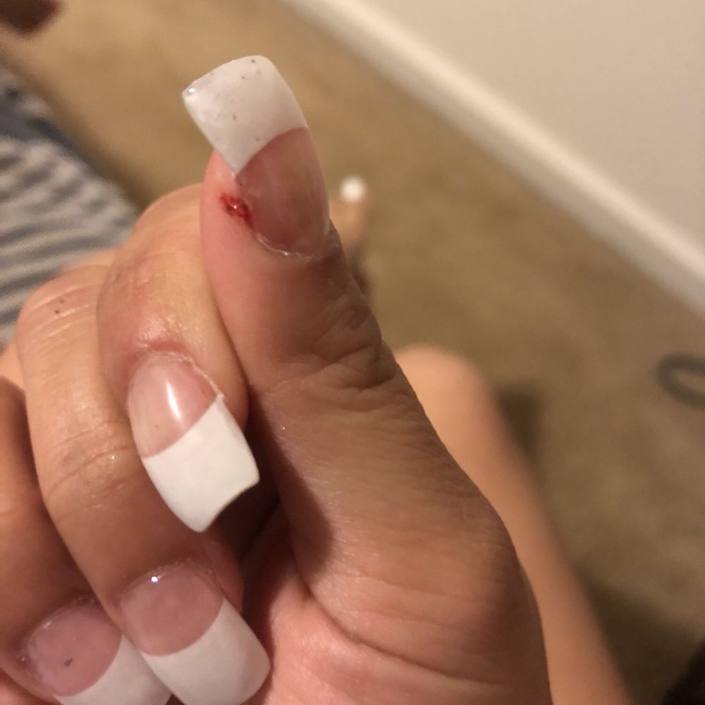 Solar Nails - Made me bleed from filing way too hard - Nail Salons Near Me - Leesville, Louisiana Solar Nails - Made me bleed from filing way too hard - Nail Salons Near Me - Leesville, Louisiana