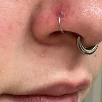 Liquid Ink - Irritated piercing done wrong more than once from the same shop despite proper care and cleaning at home. - Tattoo Near Me - Lubbock, Texas Liquid Ink - Irritated piercing done wrong more than once from the same shop despite proper care and cleaning at home. - Tattoo Near Me - Lubbock, Texas