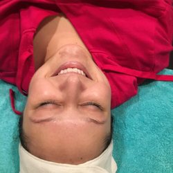 Simply Smooth - Happy client after her peel