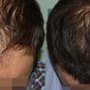 Photo of Pure Hair Restoration Center