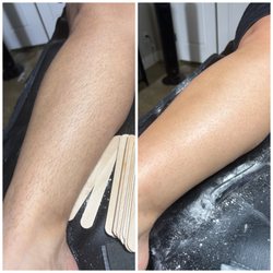 Wax Appeal - Full leg wax before and after
