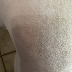 Irritated skin all over her body!