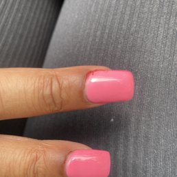 Bleeding fingers Bleeding fingers
