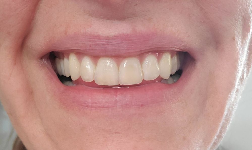 HANSEN ORTHODONTICS Updated August 2024 45 Photos & 37 Reviews