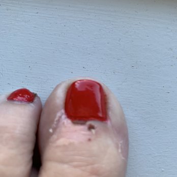 LaBelle Nails & Spa - Cut and scabbed cuticle. - Nail Salons Near Me - Jackson, New Jersey